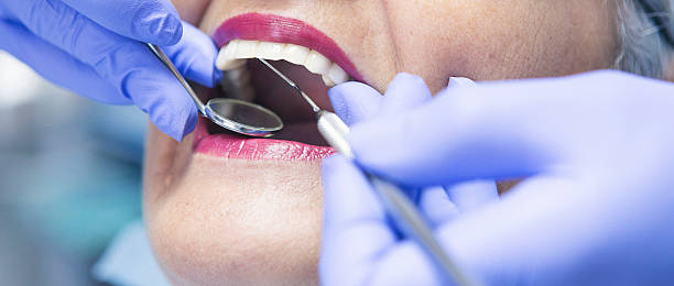 Best Knocked-Out Tooth Emergency  in Holgate, OH
