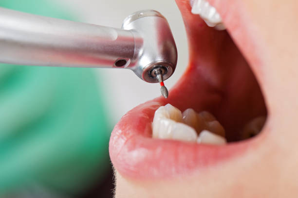 Best Tooth Infection Emergency Dentist  in Holgate, OH